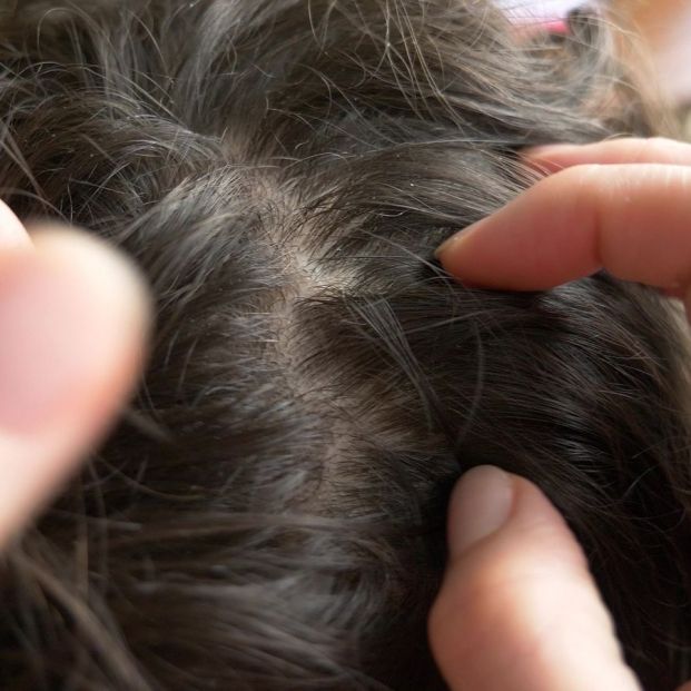 número de los piojos