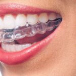 ortodoncia invisible